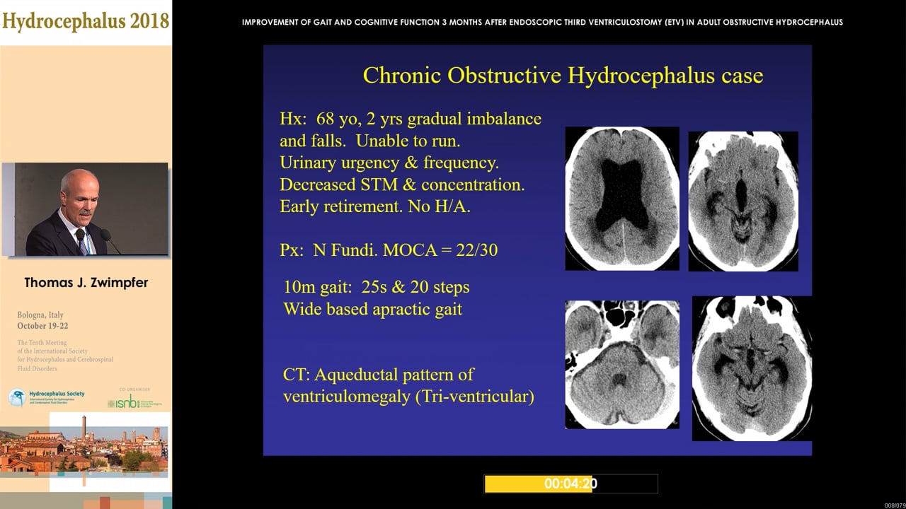 30 - Thomas J. Zwimpfer