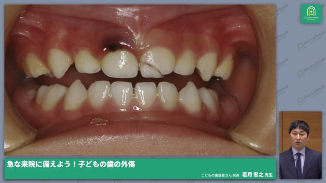 子どもの歯の外傷 緊急来院時の対応の流れ #1