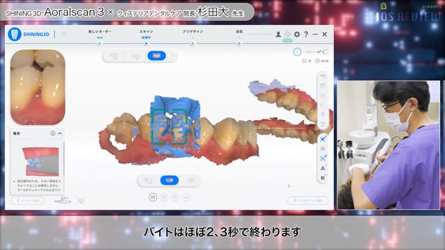 【口腔内スキャナー比較動画】第6弾 〜SHINING3D社 AORALSCAN 3〜