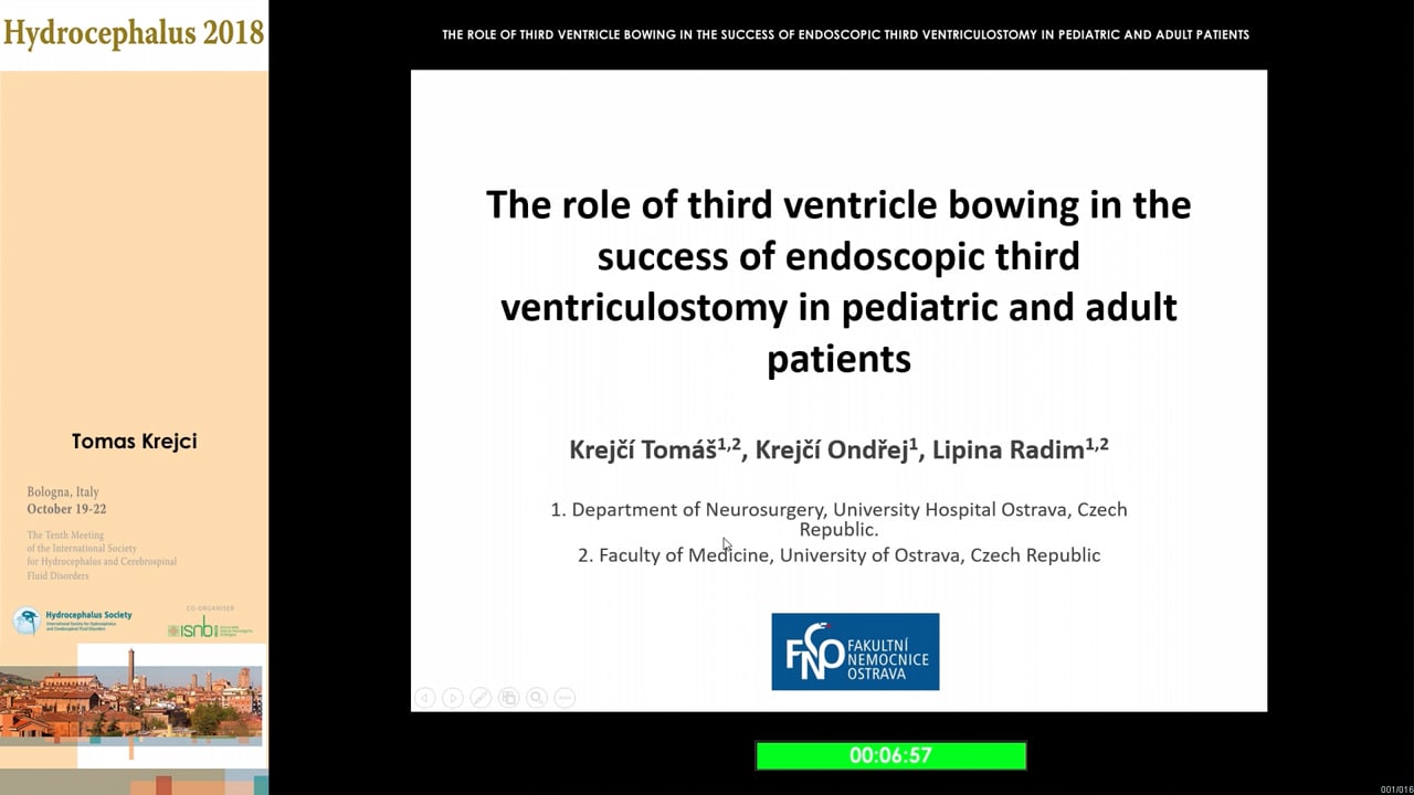 58 - Tomáš Krejčí