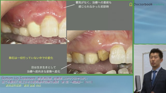 歯科医師を続ける意味 #2