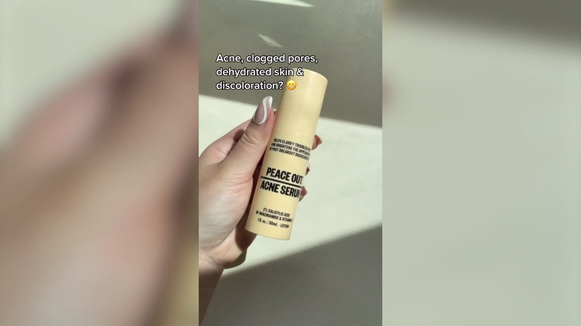 Salicylic Acid Acne Treatment Serum – Peace Out Skincare
