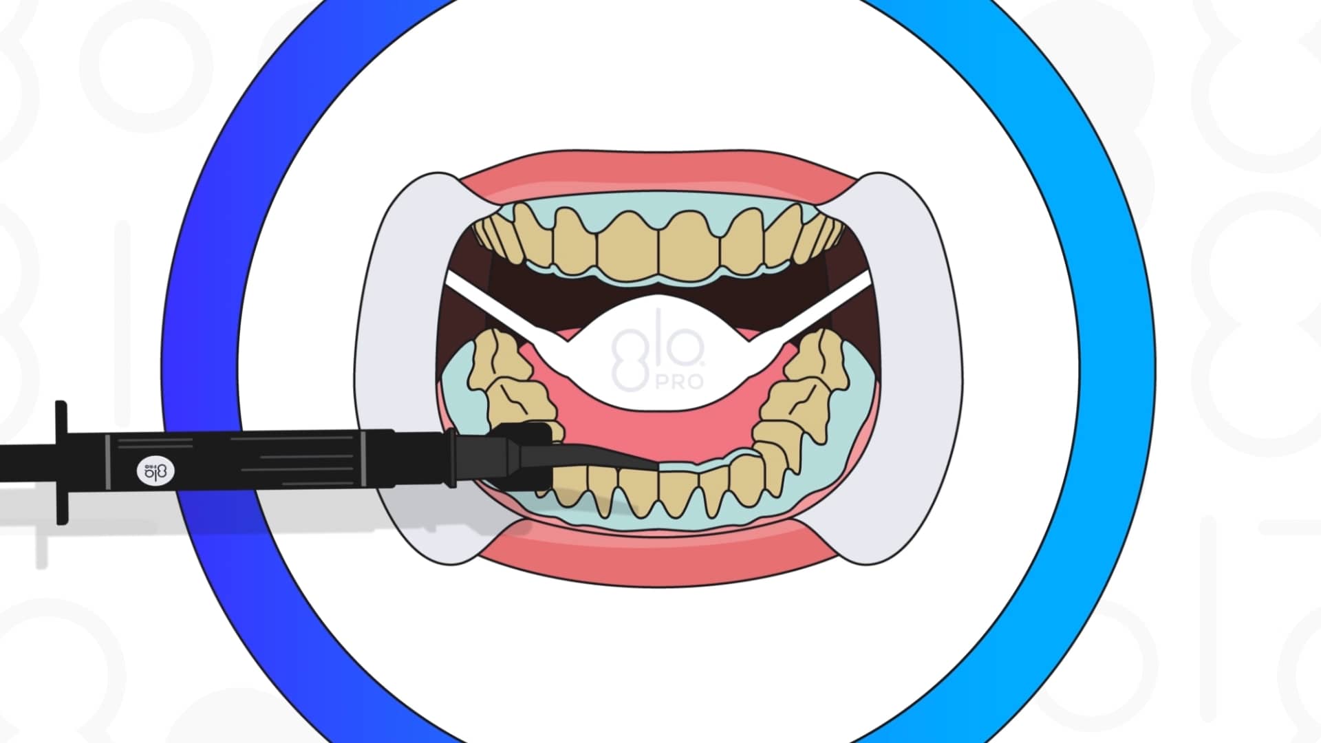 Sage Dental GLO PRO POWER+ In Office Training Video Animation 1920x1280