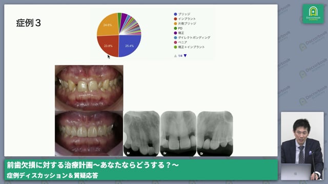 月星 太介先生・相宮 秀俊先生による症例ディスカッション＆質疑応答 #3