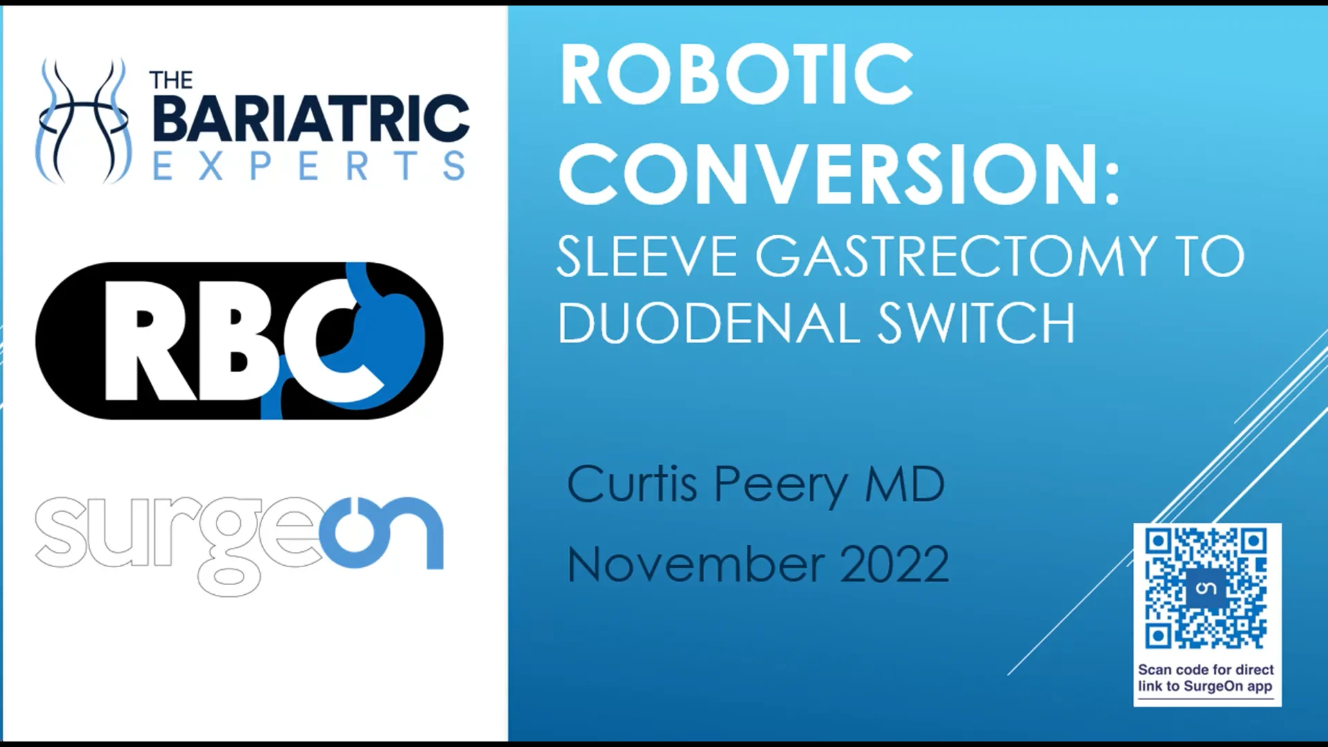 Robotic Conversion Sleeve to Duodenal Switch on Vimeo