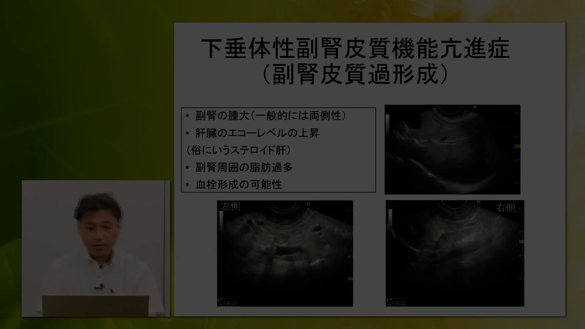 腹部エコー完全習得ガイド～膵臓・副腎・尿管～ | 株式会社 医療