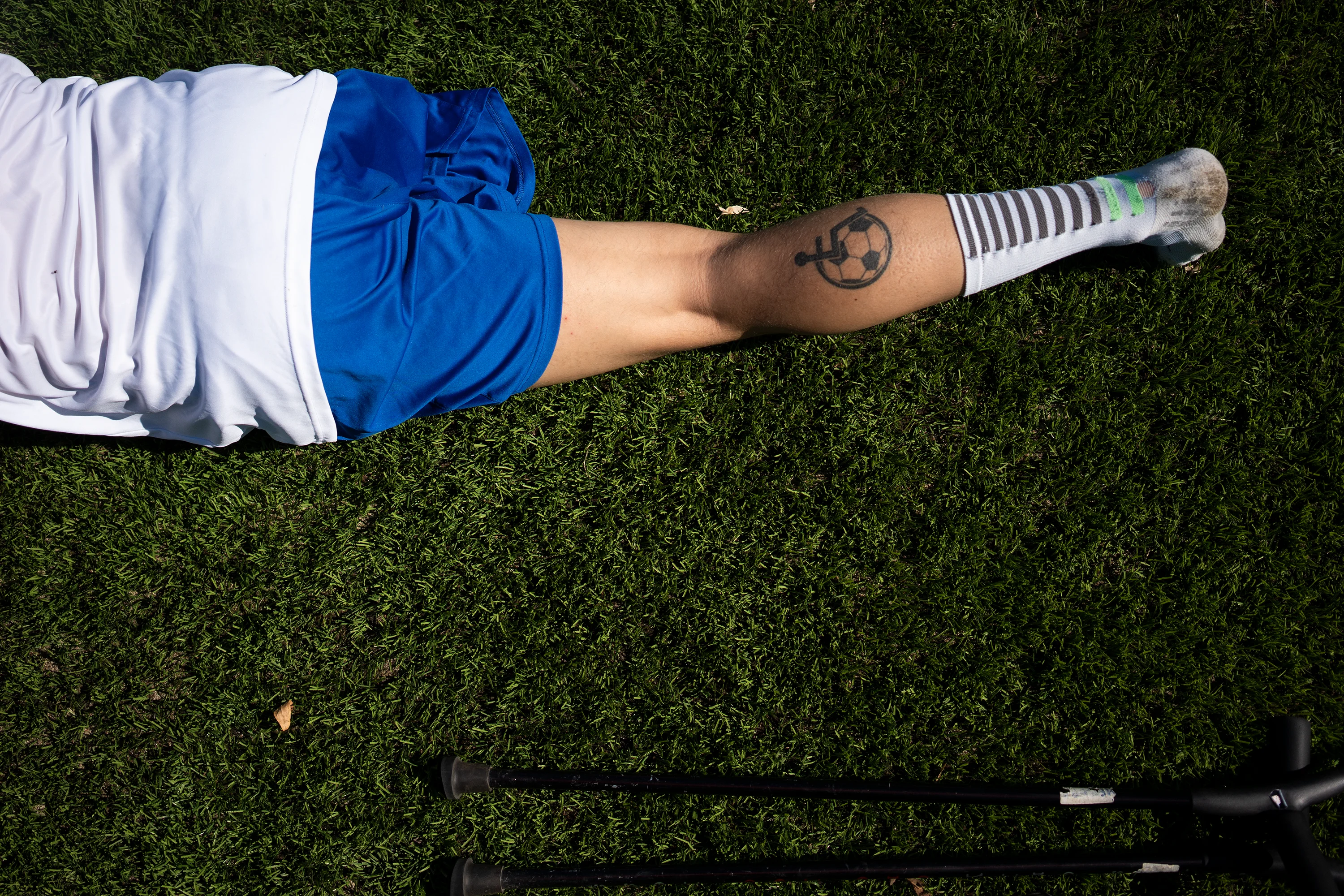 IT'S ONLY ONE LEG LESS - reportage (12 min) on Vimeo