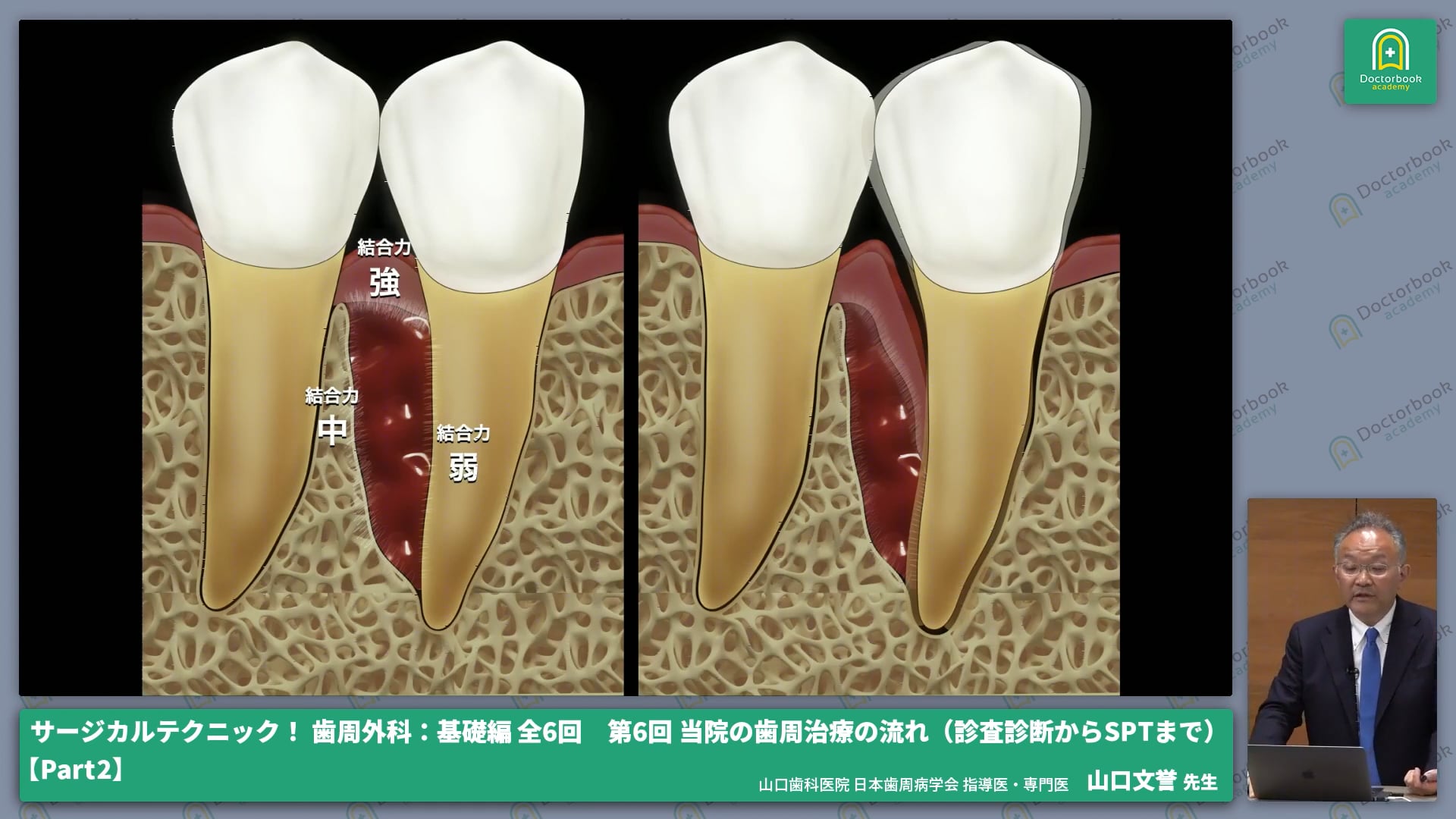 イニシャルトリートメントの評価・再生療法における術前準備 #2