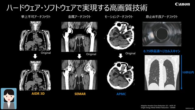 16列CT　Aquilion Startの特長　-第1部-