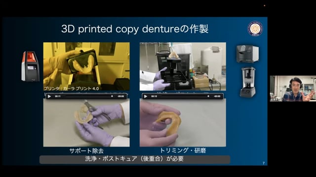 1年使ってわかった3D printed denture の世界│金澤 学先生 #1