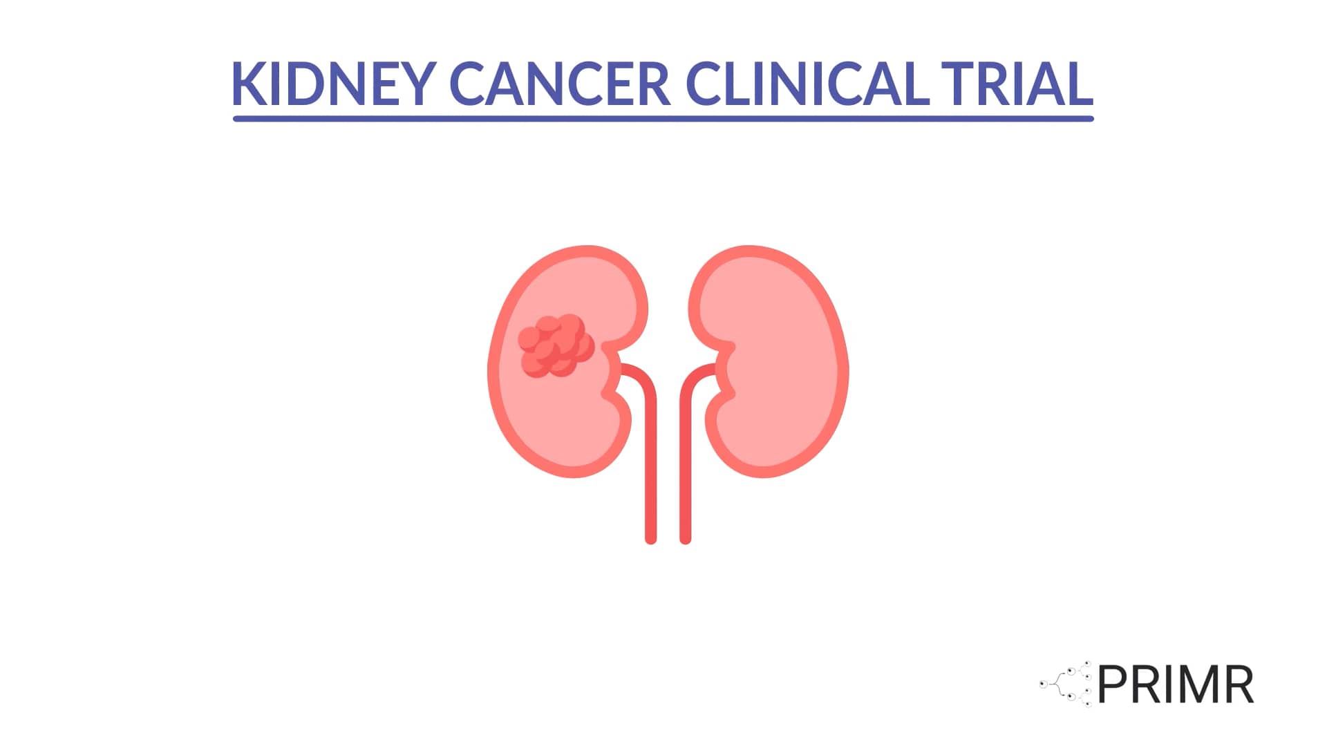 Kidney Cancer Clinical Trial: The RadiCaL Study on Vimeo