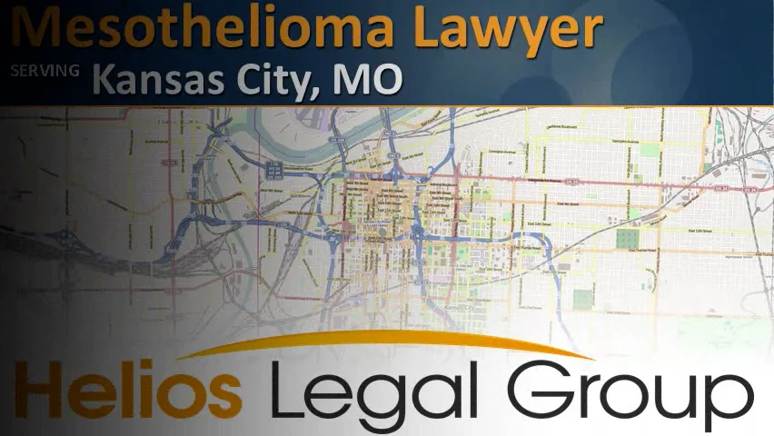 Kansas city mesothelioma lawyer vimeo