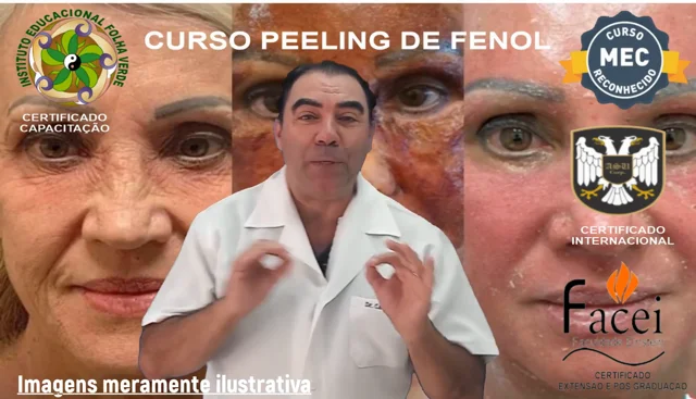 Certificado Curso de Peeling