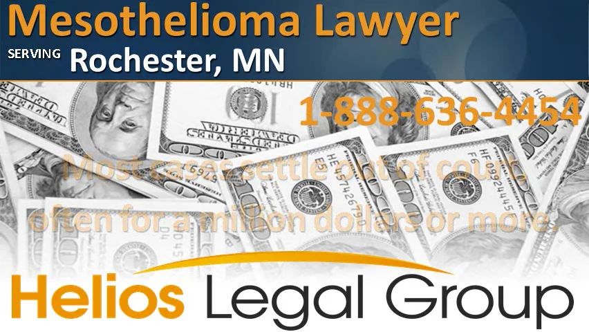 Rochester mesothelioma lawyer vimeo