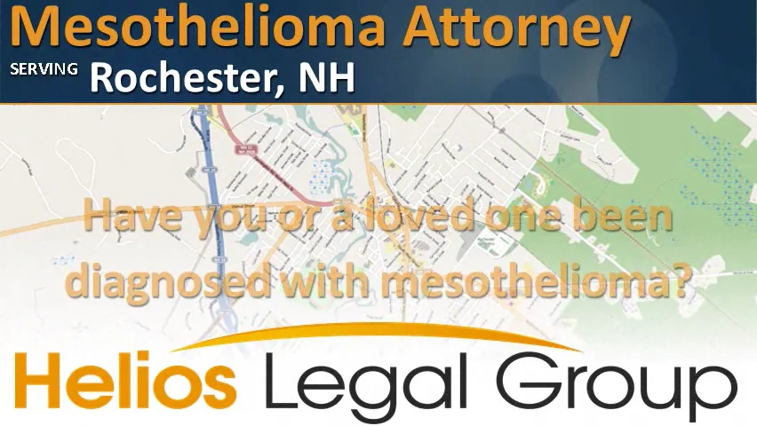 Rochester mesothelioma lawyer vimeo