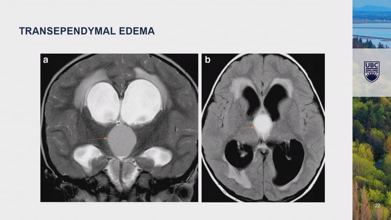 102 - Mandeep Tamber