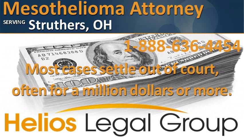 Indianapolis mesothelioma lawyer vimeo