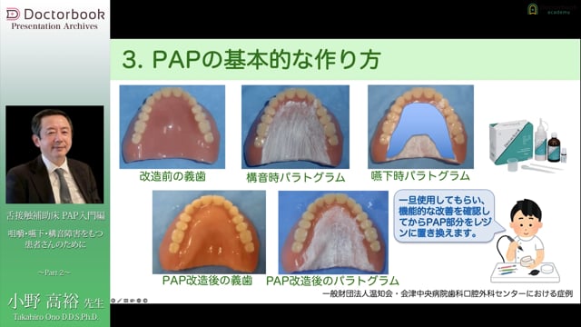 PAPの作製方法と医科歯科連携 #2