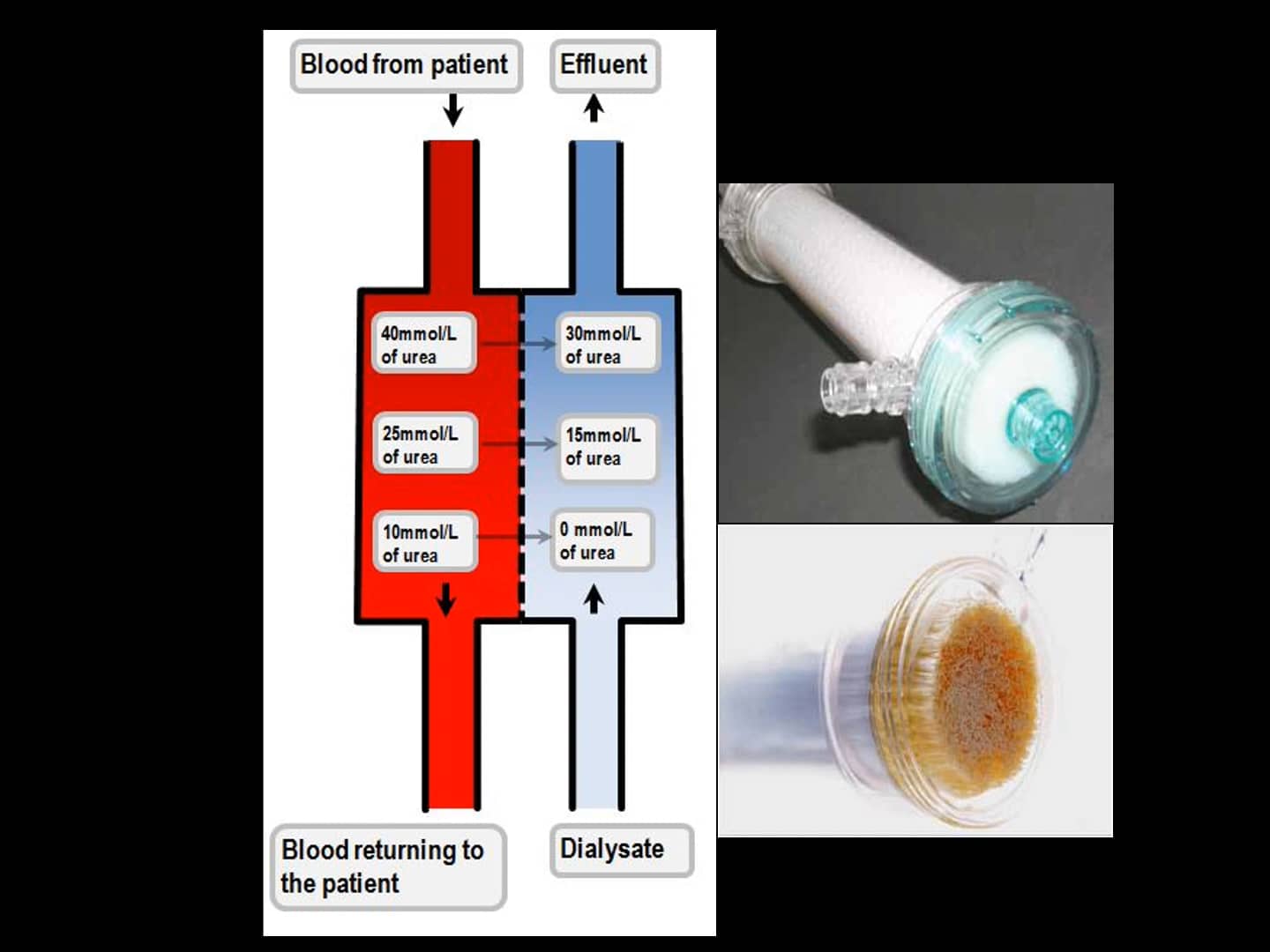 The BasicsHemodialysis, SLED & CRRT.mp4 on Vimeo