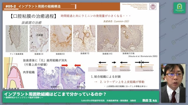 インプラント周囲軟組織はどこまで分かっているのか？ ～基礎研究からインプラント臨床を紐解く～ #1