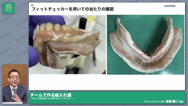 経験豊富な歯科医師と歯科技工士で作る義歯の症例と本当の価値│岩城 謙二先生 #2