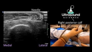 Injection Basics