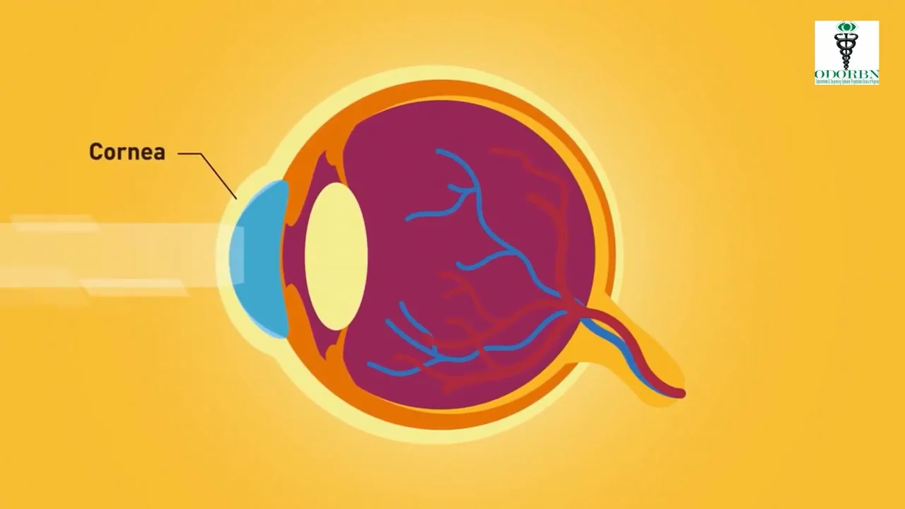 Video on Myopia.mov on Vimeo