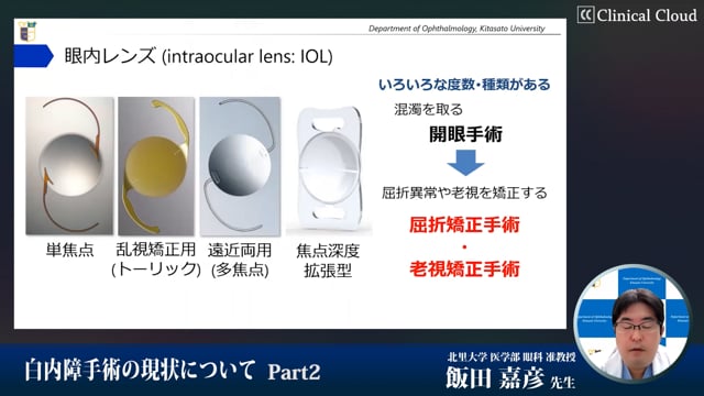 白内障手術の現状について　Part2