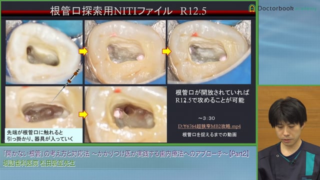 新品未使用】治癒の歯内療法 - 健康/医学