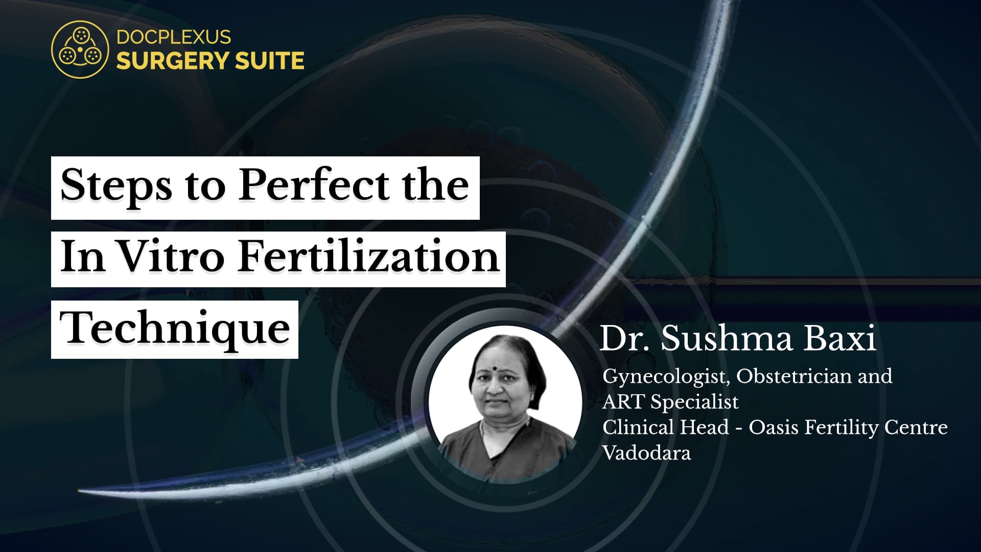 Steps to Perfect the In Vitro Fertilization Technique