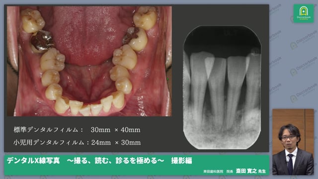 基礎から極めるデンタルX線写真撮影の撮り方と読み方