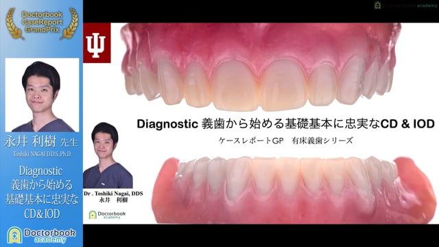 【ケースレポートGP有床義歯セッション】No.3 永井利樹先生「Diagnostic 義歯から始める基礎基本に忠実なCD&IOD」