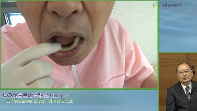義歯の破損と予備の義歯の必要性 #5