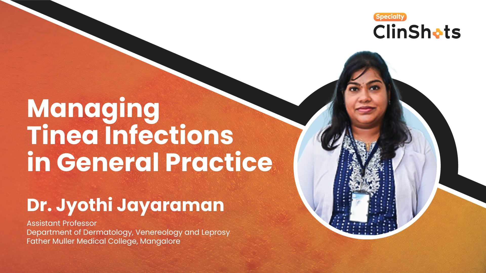 Managing Tinea Infections in General Practice