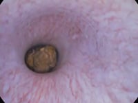 EVR urethrocystoscopy dog with urethral stone obstruction os penis