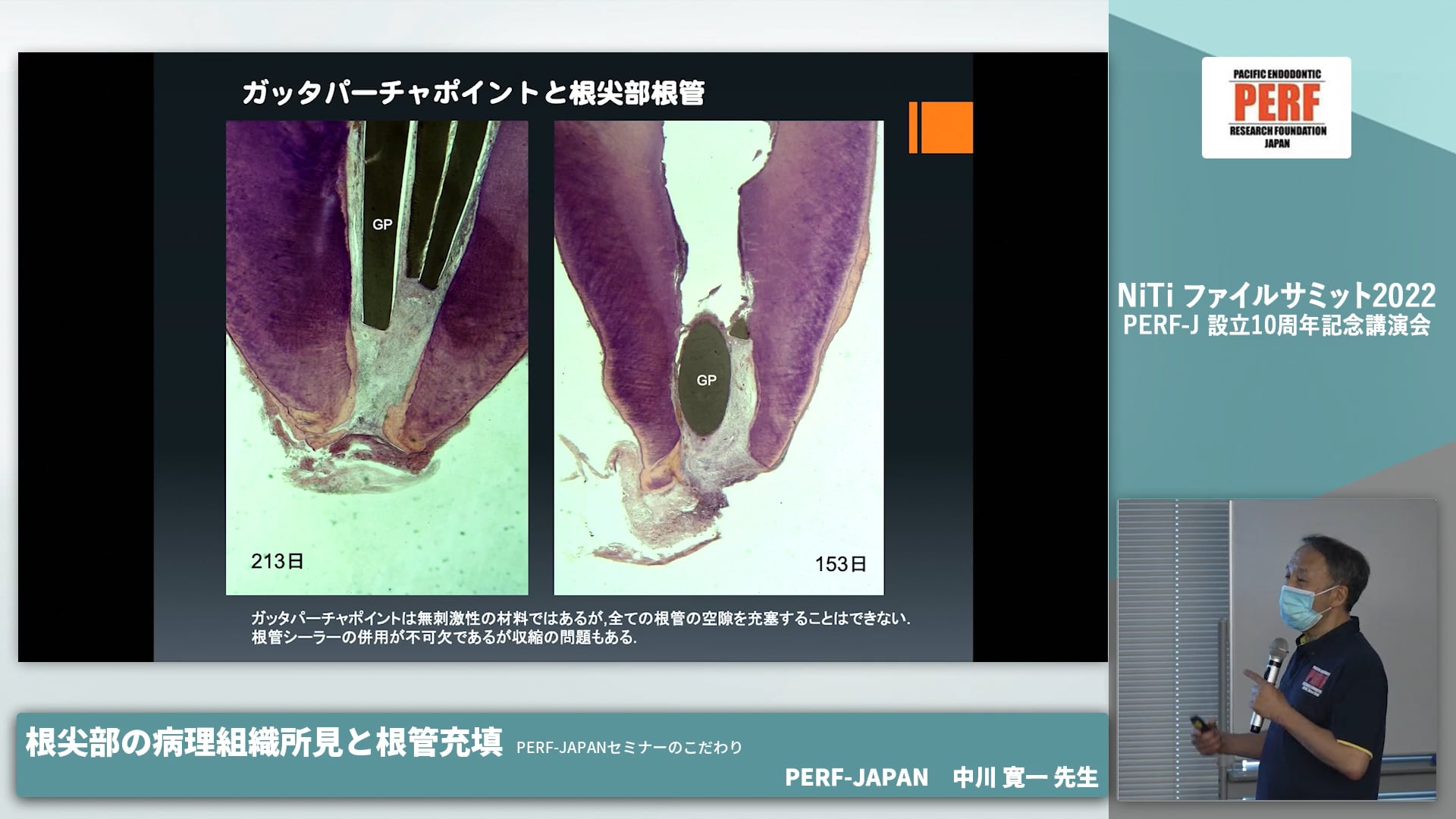 根尖部の病理組織所見と根管充填 PERF-JAPAN セミナーのこだわり│中川寛一先生