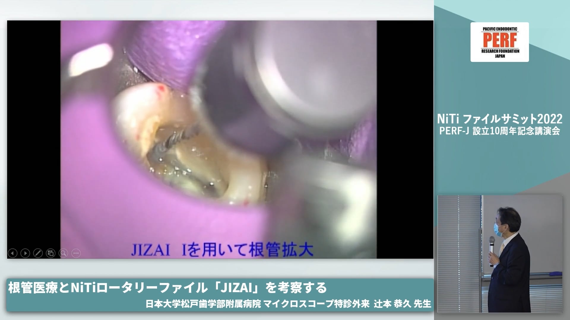 根管治療とNiTiロータリーファイル「JIZAI」を考察する 日本大学松戸歯学部付属病院マイクロスコープ特診外来│辻本恭久先生