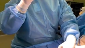 Live surgery malunion of index finger