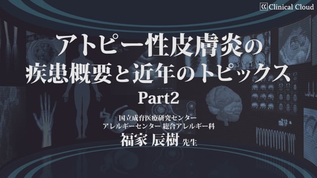 アトピー性皮膚炎の疾患概要と近年のトピックス Part2