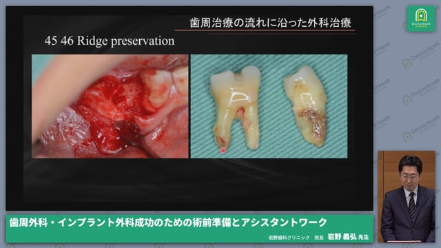 歯周外科・インプラント外科成功のための術前準備とアシスタントワーク