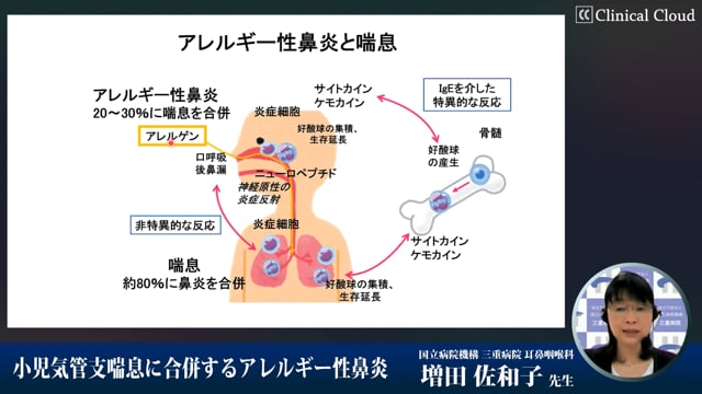 小児気管支喘息に合併するアレルギー性鼻炎