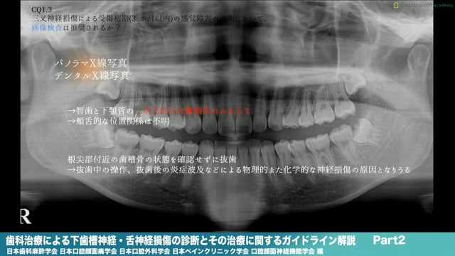 『歯科治療による下歯槽神経・舌神経損傷の診断とその治療に関するガイドライン』解説 Part2
