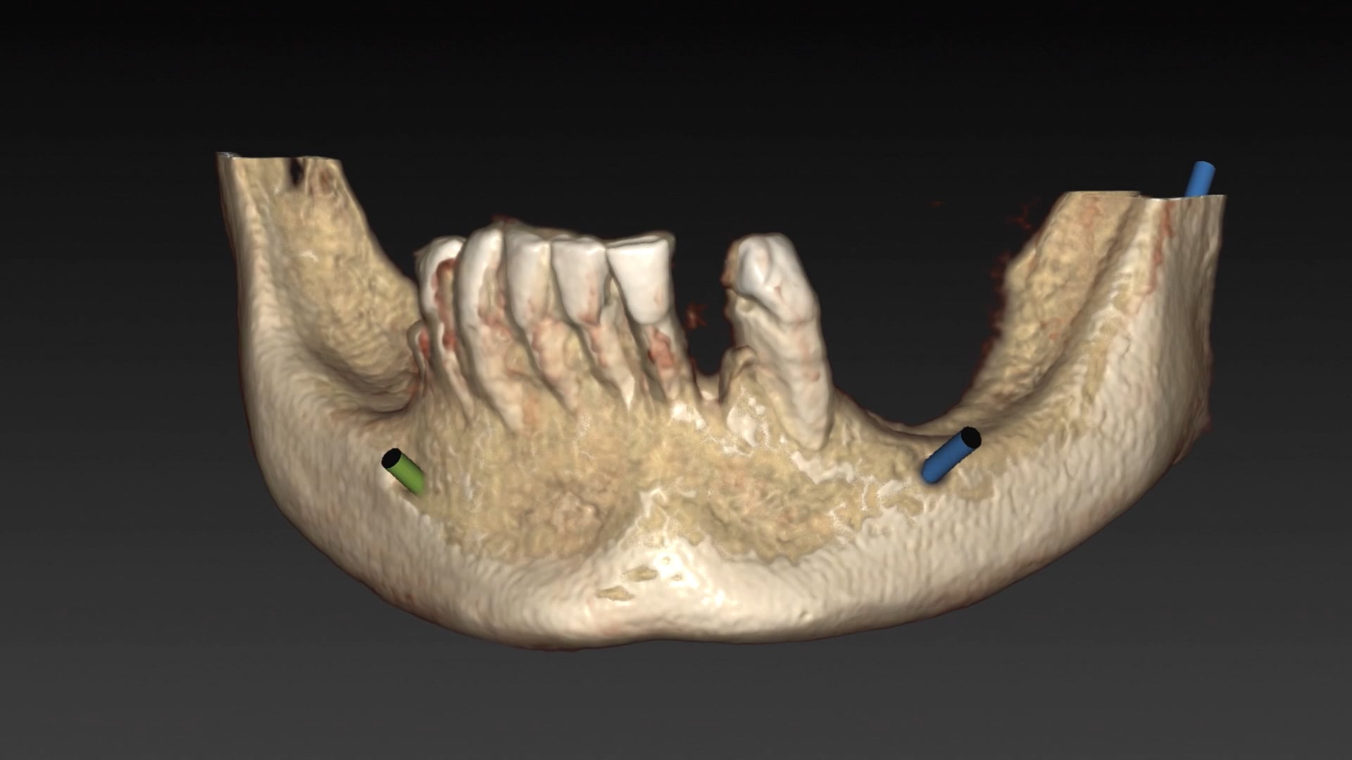 COMPLETE ANATOMY DEMOS FOR EDUCATORS ON VIMEO visual data 5