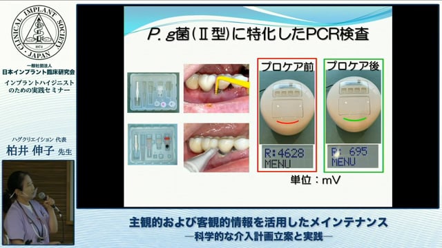 主観的および客観的情報を活用したメインテナンス―科学的な介入計画立案と実践―│柏井 伸子先生