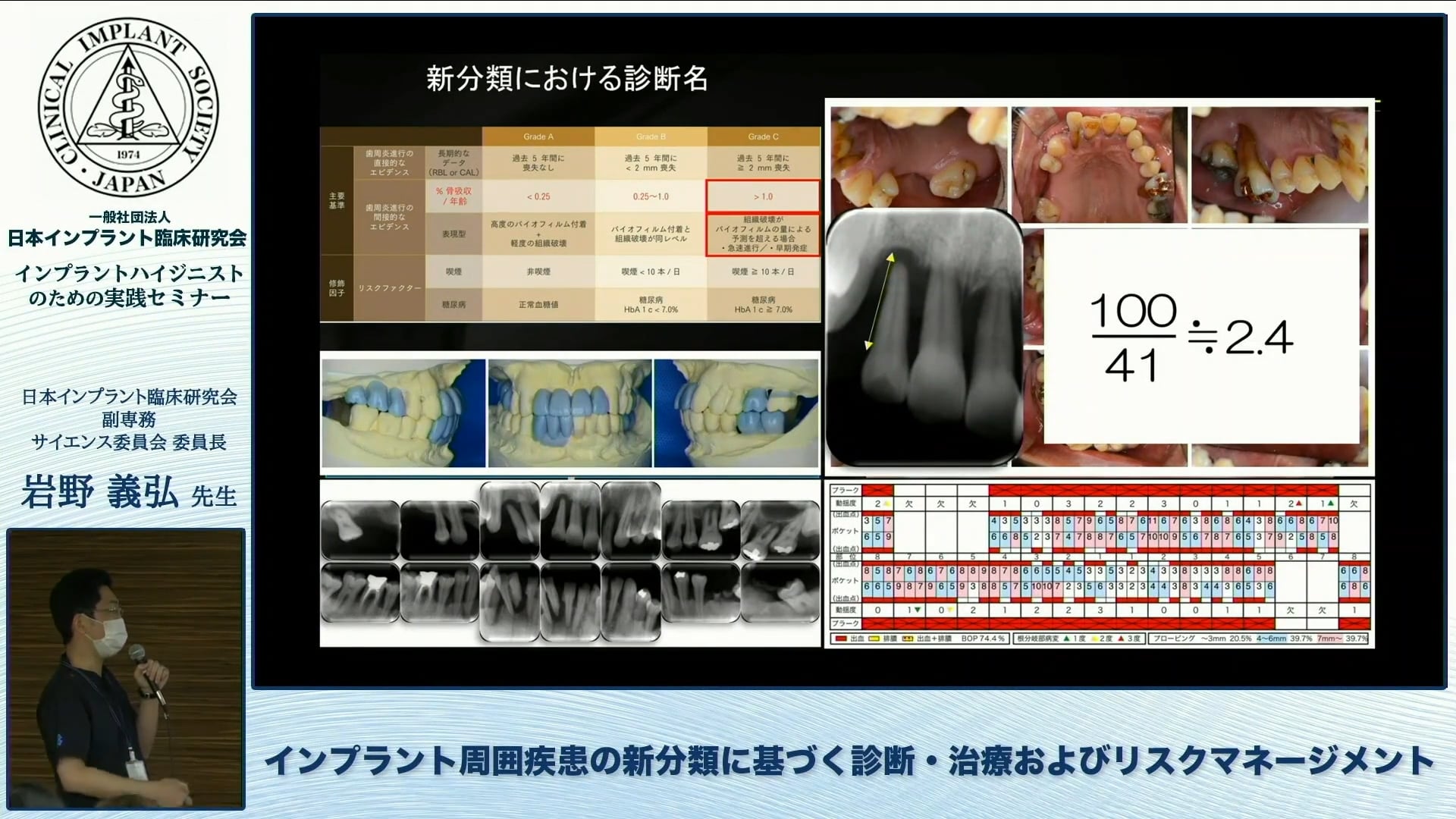 インプラント周囲疾患の新分類に基づく診断・治療およびリスクマネージメント│岩野 義弘先生