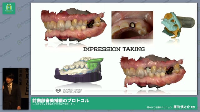 前歯部審美補綴のプロトコル-クオリティを求めたデジタルアプローチ- 原田 慎之介先生