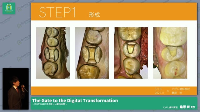 The Gate to the Digital Transformation 〜IOSからはじまる新しい歯科治療 桑原 崇先生