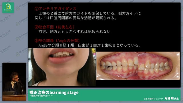 矯正治療のlearning stage〜臨床20年を振り返って〜 丸目 剛先生