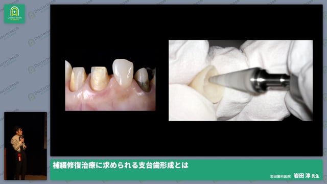 招待講演「補綴修復治療に求められる支台歯形成とは」 #10 岩田 淳先生