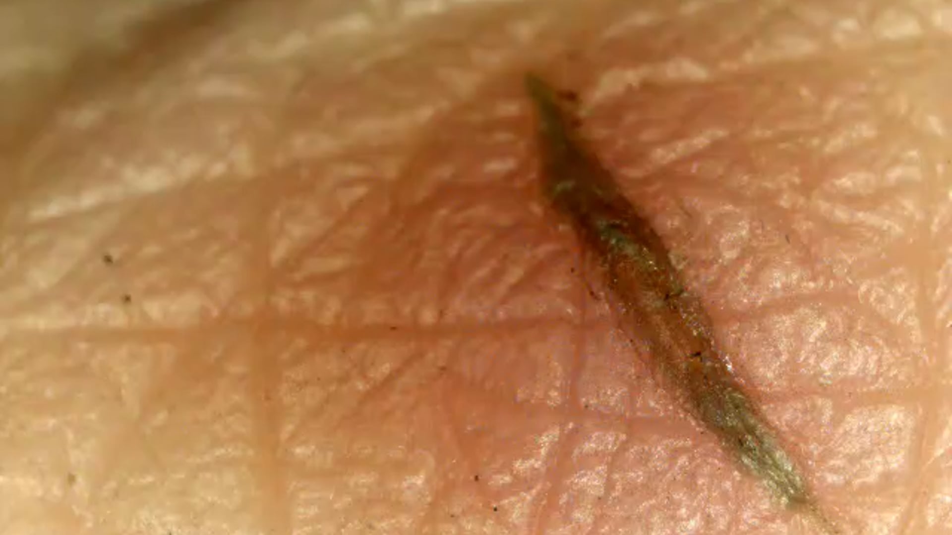 FINGER KNUCKLE CROSS BANDING OPENING..mp4